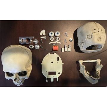 Head Turn Kit